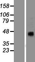 P2RX4 Human Over-expression Lysates NM_002560