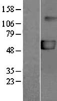 ls005026 p2x5 p2rx5 human over expression lysates nm 002561 wb testing 1
