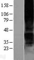 P2Y1 (P2RY1) Human Over-expression Lysates NM_002563