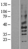 ls005029 p2y2 p2ry2 human over expression lysates nm 176072 wb testing 1