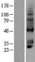 P2Y4 (P2RY4) Human Over-expression Lysates NM_002565