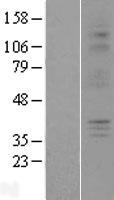 P2Y6 (P2RY6) Human Over-expression Lysates NM_176797