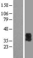 ls005031 p2y6 p2ry6 human over expression lysates nm 176798 wb testing 2