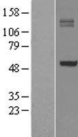 P4HA1 Human Over-expression Lysates NM_000917