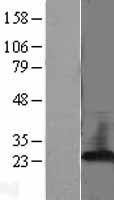 PBP (PEBP1) Human Over-expression Lysates NM_002567