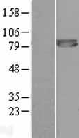 FURIN Human Over-expression Lysates NM_002569