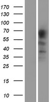 PACE4 (PCSK6) Human Over-expression Lysates NM_138322