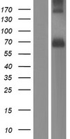 PACE4 (PCSK6) Human Over-expression Lysates NM_138324