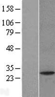 PAFAH1B2 Human Over-expression Lysates NM_002572