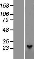 Peroxiredoxin 1 (PRDX1) Human Over-expression Lysates NM_002574