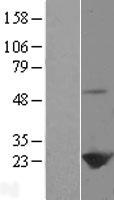 Peroxiredoxin 1 (PRDX1) Human Over-expression Lysates NM_181696