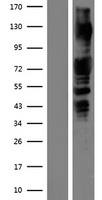 ls005058 pak1 human over expression lysates nm 001128620 wb testing 1