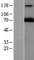 PARN Human Over-expression Lysates NM_002582
