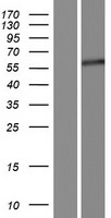 PAX3 Human Over-expression Lysates NM_181457