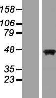 PAX5 Human Over-expression Lysates NM_016734