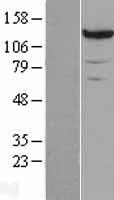 PCB (PC) Human Over-expression Lysates NM_000920