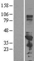PCBP1 Human Over-expression Lysates NM_006196