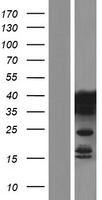 PCBP2 Human Over-expression Lysates NM_001098620