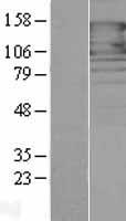 PCDH1 Human Over-expression Lysates NM_032420