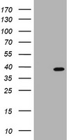 PCNA Human Over-expression Lysates NM_002592