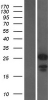 CHMP1A Human Over-expression Lysates NM_002768