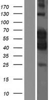 PCTAIRE1 (CDK16) Human Over-expression Lysates NM_001170460