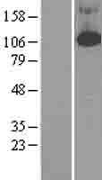 PDE4 (PDE4B) Human Over-expression Lysates NM_002600