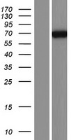 PDE4C Human Over-expression Lysates NM_001098819