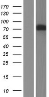 PDE4D Human Over-expression Lysates NM_001197222