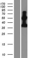 PDE9A Human Over-expression Lysates NM_001001568