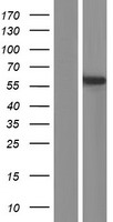 PDE9A Human Over-expression Lysates NM_001001571