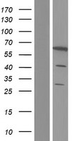 PDE1B Human Over-expression Lysates NM_001165975