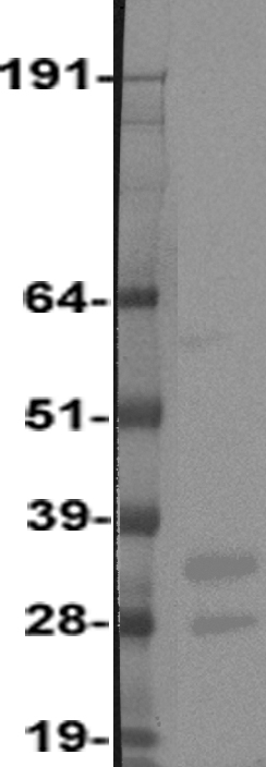 PDGF beta (PDGFB) Human Over-expression Lysates NM_002608