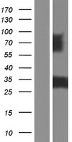 PDGF beta (PDGFB) Human Over-expression Lysates NM_033016