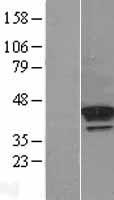 PDGFRL Human Over-expression Lysates NM_006207