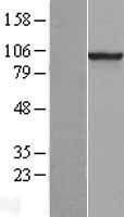 PDE6 beta (PDE6B) Human Over-expression Lysates NM_000283