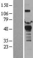 PDK1 Human Over-expression Lysates NM_002610