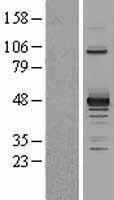 PDK2 Human Over-expression Lysates NM_002611