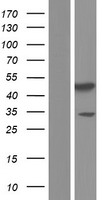 PDK3 Human Over-expression Lysates NM_001142386