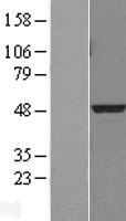 PDK3 Human Over-expression Lysates NM_005391