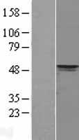 PDK4 Human Over-expression Lysates NM_002612