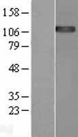 ENPP1 Human Over-expression Lysates NM_006208