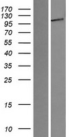 ENPP1 Human Over-expression Lysates NM_006208