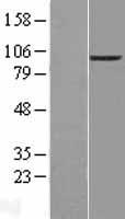 ENPP2 Human Over-expression Lysates NM_001040092
