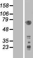 PDPK1 Human Over-expression Lysates NM_002613