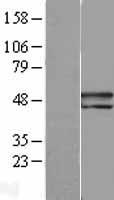 PEDF (SERPINF1) Human Over-expression Lysates NM_002615