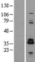 ls005179 enkephalin penk human over expression lysates nm 001135690 wb testing 1
