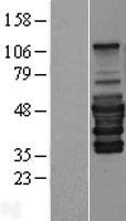 PEX14 Human Over-expression Lysates NM_004565
