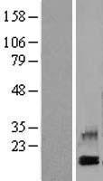 PF4 Human Over-expression Lysates NM_002619