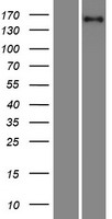 PFAS Human Over-expression Lysates NM_012393